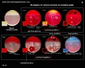 identification bacteria isolation plate
